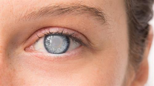 視力變模糊?  認識青光眼和白內障  兩者成因、後果、治療方法大不同